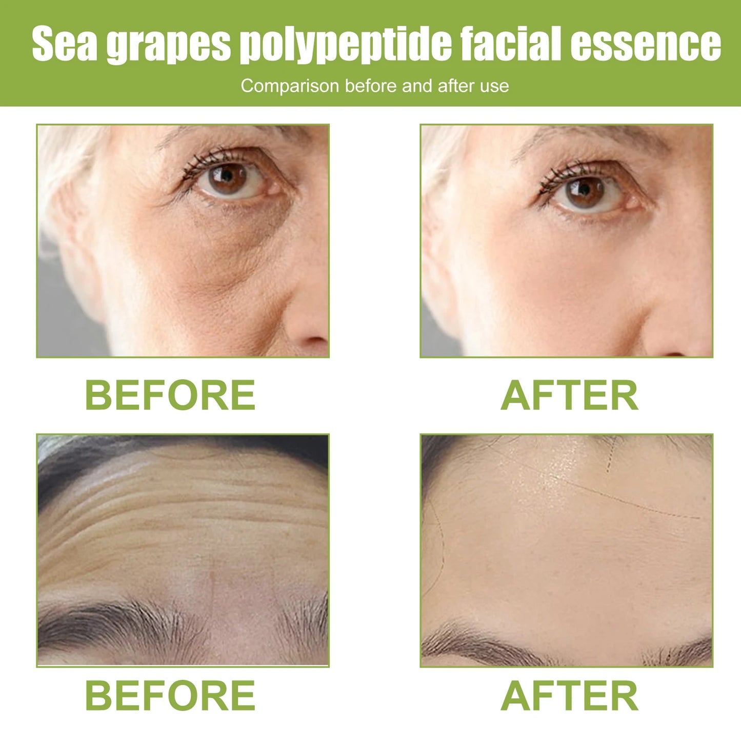 Eelhoe Sea Grape Polypeptide Facial Serum Anti Aging Moisturizing Booster