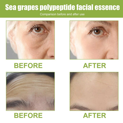 Eelhoe Sea Grape Polypeptide Facial Serum Anti Aging Moisturizing Booster