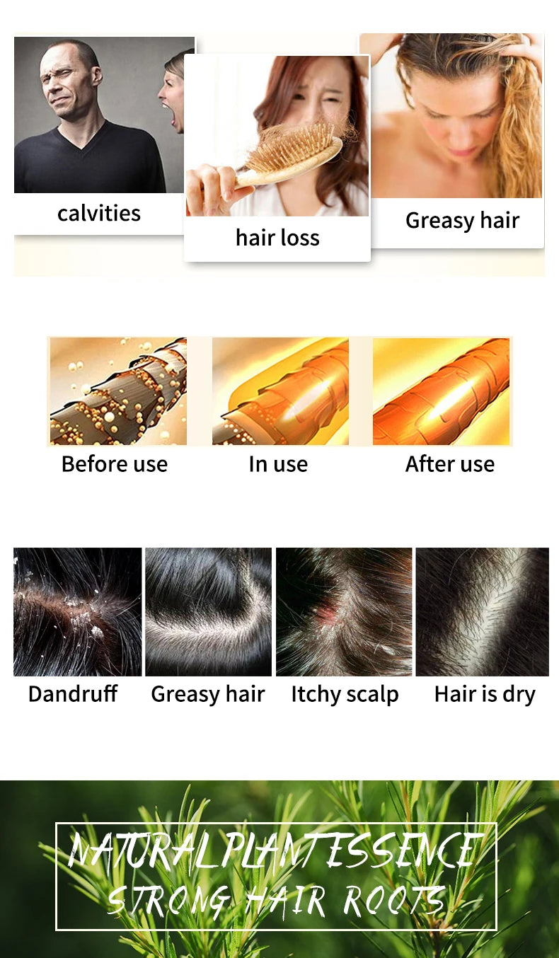 Tea Tree Essential Oil Shampoo For Hair Care Dandruff Control 60g Handmade