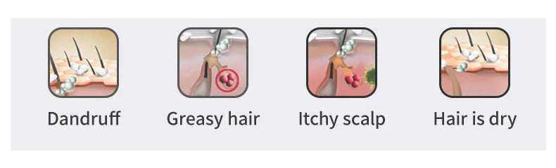 Tea Tree Essential Oil Shampoo For Hair Care Dandruff Control 60g Handmade